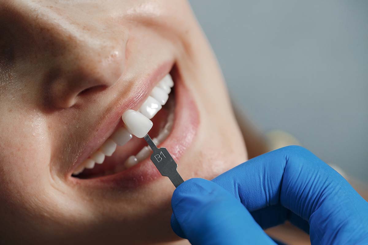 https://smilesdentistry.nexus-solutions.co.bw/wp-content/uploads/2024/07/dentist-whiting-teeth.jpg